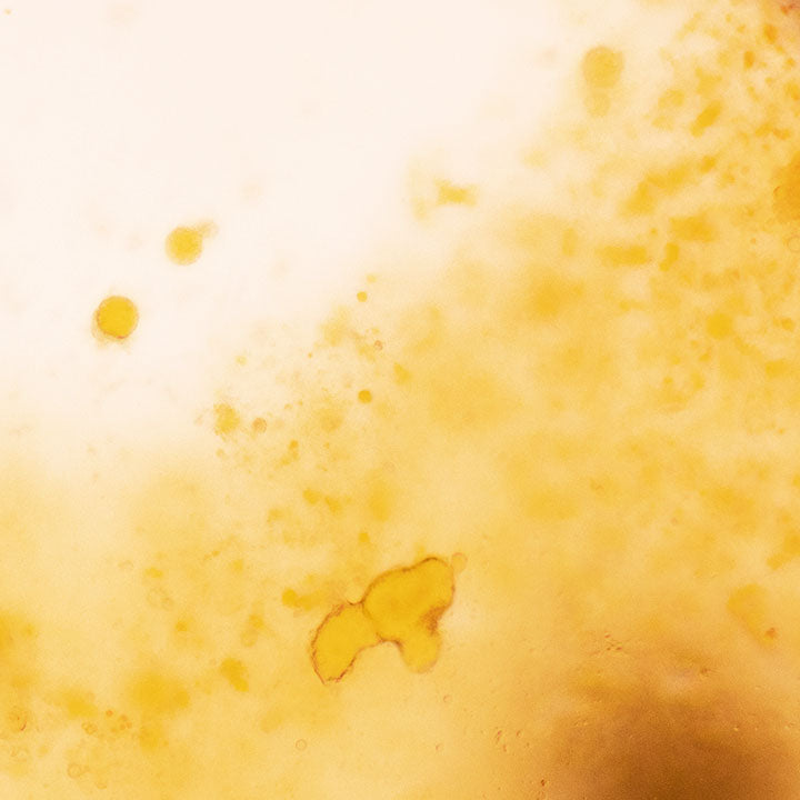 fermentation liquid
